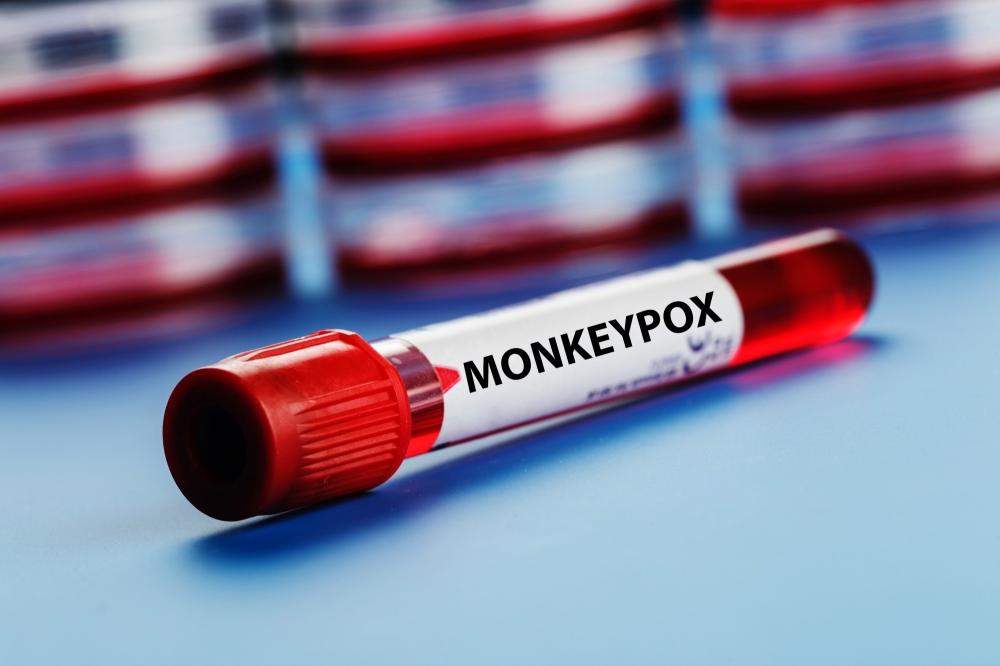 The Weekend Leader - Delhi records second monkeypox case, nationwide tally reaches 6