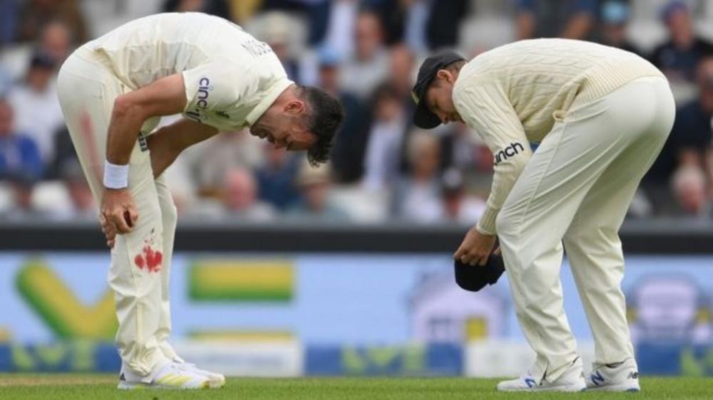 The Weekend Leader - James Anderson continues to bowl despite a bleeding knee